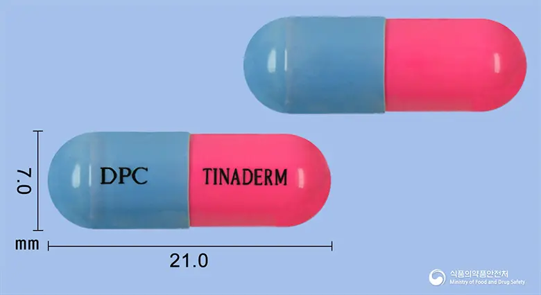 티나덤캡슐(이트라코나졸) 앞뒤 사진 (파란색 캡슐, 각인 DPC TINADERM)