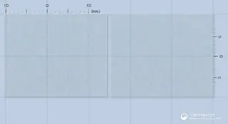 몬테프리오디에프4밀리그램(몬테루카스트나트륨) 사진